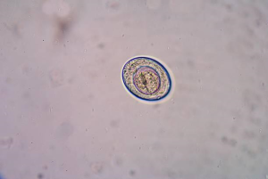 4.    Worm